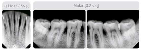 incisor-y-molar-español-02